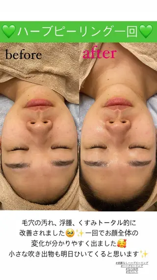 Salon de Lino 御器所のエステ・リラクイメージ