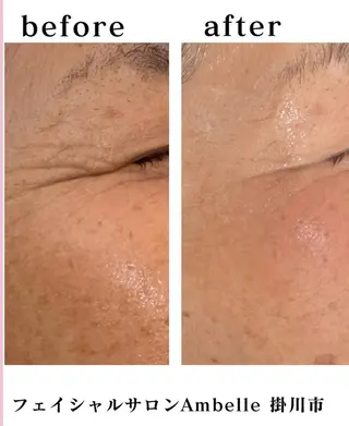 サロン　Ambelle所属・北川 亜友美のエステ・リラクイメージ