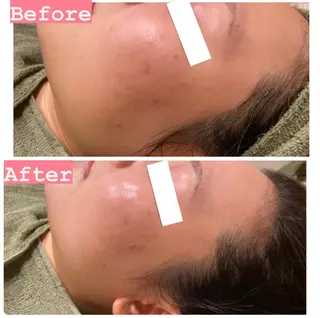 ハーブピーリング専門 muro.のエステ・リラクイメージ