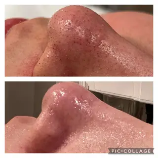 溝の口エステranan所属・化粧品成分研究/講師 ranan三浦のエステ・リラクイメージ