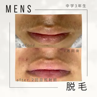 メンズ private salon    olu olu所属・生井 美枝のエステ・リラクイメージ