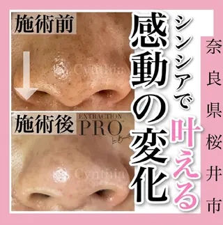 メンズ 毛穴ケア専門店 Cynthiaのエステ・リラクイメージ