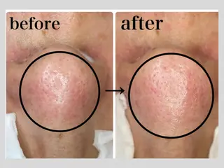 マツエク・マツパ 韓国肌管理 【毛穴専科】のエステ・リラクイメージ