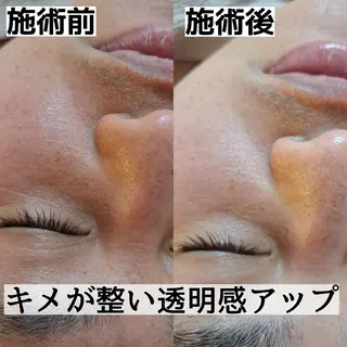 DeRiii所属・DeRiii 毛穴・ 保湿ケアまつ毛パーマのエステ・リラクイメージ