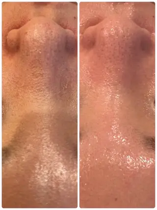 private salon éclat所属・ニキビ・毛穴専門 éclat/エクラのエステ・リラクイメージ