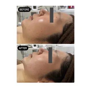 IBERIA心斎橋店 🌼凝り小顔美肌痩身のエステ・リラクイメージ