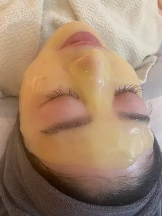 肌質改善 KALANCHOEのエステ・リラクイメージ