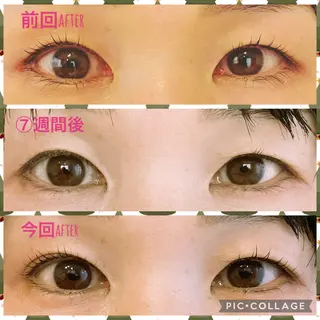 マツエク・マツパ Matricaria AKIのマツエク・マツパデザイン