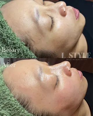 韓国式美人肌育成/美肌WAXサロン【L_style.】所属・【L_style.】 エルスタイルのエステ・リラクイメージ