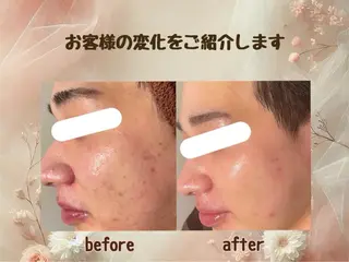 小顔矯正&美肌サロン ブプラ大元駅前店のエステ・リラクイメージ