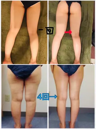 リラクゼーション ルナのエステ・リラクイメージ