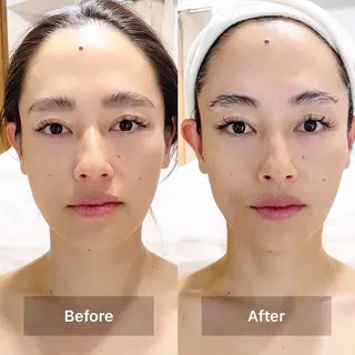 Hanare by La Mariage所属・Hanare by La Mariageのエステ・リラクイメージ