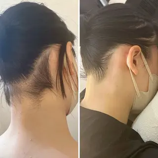 うなじ脱毛/美肌脱毛 LABELのエステ・リラクイメージ