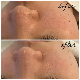 メンズ メナード岐阜市茜部 杉浦のエステ・リラクイメージ