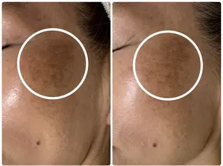 シミ毛穴専門店 yucca(ユッカ)のエステ・リラクイメージ