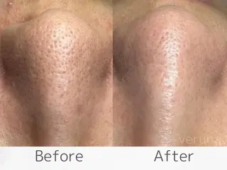 べアール所属・小顔/毛穴/ニキビ salon bealのエステ・リラクイメージ