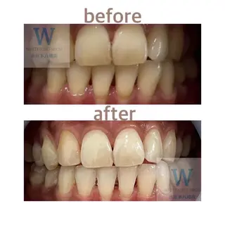 ホワイトニング ショップ本八幡店のエステ・リラクイメージ