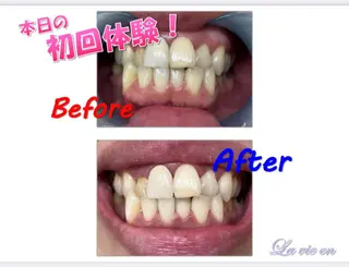 セルフホワイトニングサロン　ラヴィアン所属・ホワイトニングサロン La vie enのその他イメージ