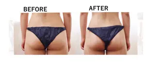 RENsalon大阪 体質改善リトリートのエステ・リラクイメージ