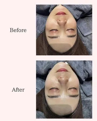 ハーブピーリング🌿 REVI/Ayanoのエステ・リラクイメージ