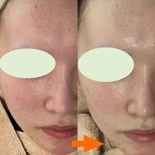 mili mili beauty salon所属・mili mili 岡本のエステ・リラクイメージ