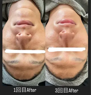 メンズ Its Yoshikaのエステ・リラクイメージ