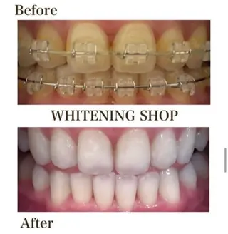 ホワイトニングショップ伊丹店所属・ホワイトニング ショップ伊丹店のその他イメージ