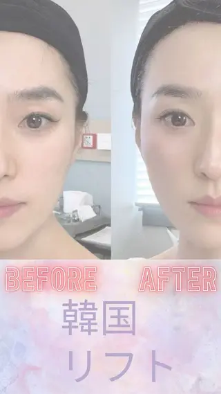 マツエク・マツパ aliaハイフ&水光ジェットサロン所属・aliaハーブ水光店 エステティシャン募集のエステ・リラクイメージ