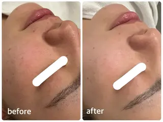 ナリス化粧品 Yumenaのエステ・リラクイメージ