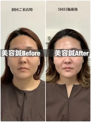 メディカルサロンドオフ所属・ハリサロンドオフ 美容鍼灸×小顔整体のエステ・リラクイメージ