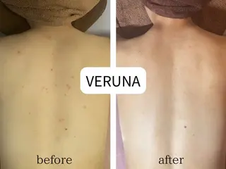 毛穴&ニキビ専門　Bonita Ange恵比寿所属・毛穴ニキビ専門 BonitaAngeのエステ・リラクイメージ