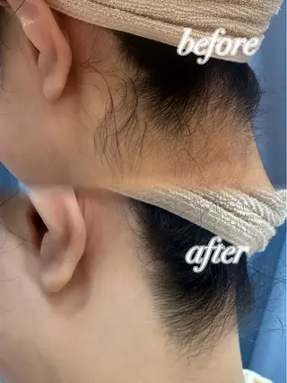 ぷる艶肌🫧 shaving斉藤のその他イメージ