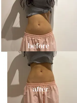 メンズ 腸活サポート みなみののエステ・リラクイメージ