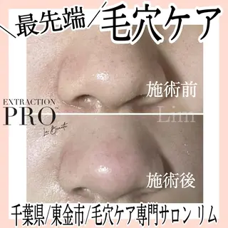 Lim Naomiのマツエク・マツパデザイン