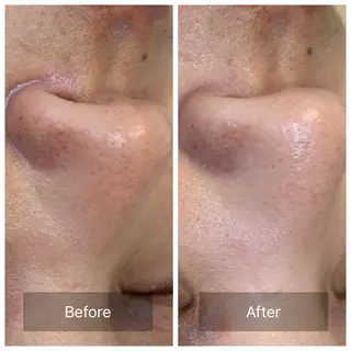 facial aesthetic salon SENTEUR所属・美肌改善/毛穴/シミ サントゥールのエステ・リラクイメージ