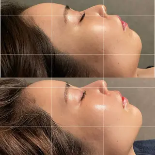 Hopeful Glowのエステ・リラクイメージ