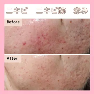 エステサロン　Sブランペタル所属・三沢市エステサロン Sブランペタルのエステ・リラクイメージ