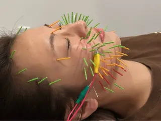 美容鍼灸Solana所属・肌質改善×美容鍼 ゆいのエステ・リラクイメージ