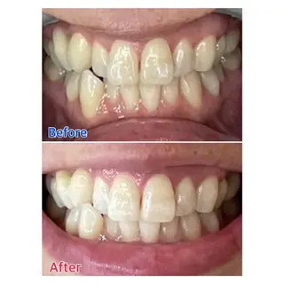 MBEAUTYSALON 千葉店・京成大久保所属・Melty 輝のその他イメージ