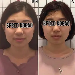 小顔矯正Speed KOGAO渋谷本店のエステ・リラクイメージ