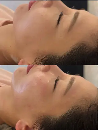 美容鍼灸サロン mahoroba院長のエステ・リラクイメージ