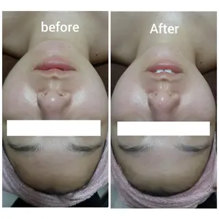 メンズ eyelash and more beauty Pilina所属・Pilina/リラク /痩身/脱毛のエステ・リラクイメージ