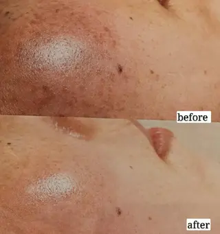 🅖🅤🅩🅔🅛 salonのエステ・リラクイメージ