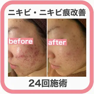 ミディアム カラー パーマ ヘアアレンジ メンズ キッズ ネイル マツエク・マツパ ニキビ・肌質改善専門 ♡人生が変わるサロンのエステ・リラクイメージ