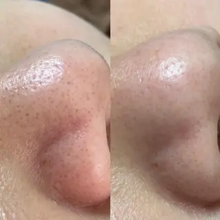 eyelashsalon Plaisir所属・ツカハラ ミカのエステ・リラクイメージ