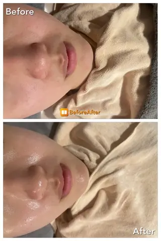 Meupニキビ専門店 背中/ハーブ/肌管理のその他イメージ