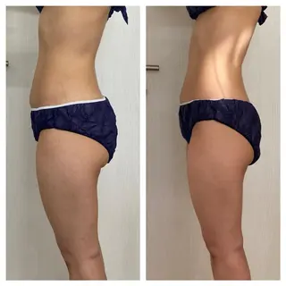 武藤 千裕のエステ・リラクイメージ