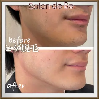 メンズ Salon de Beのエステ・リラクイメージ