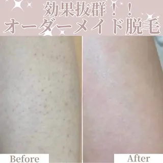 脱毛サロンALGO所属・美肌脱毛/ワックス ALGO高槻店のエステ・リラクイメージ