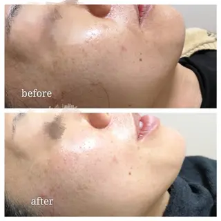 🅖🅤🅩🅔🅛 salonのエステ・リラクイメージ